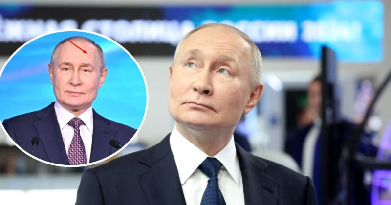 Путін отримав удар по лобі: пропагандисти пояснили походження шраму на обличчі російського президента (відео)